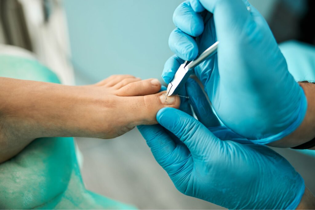 focused photo on male hands holding nail clippers 2021 09 03 23 30 06 utc@2x