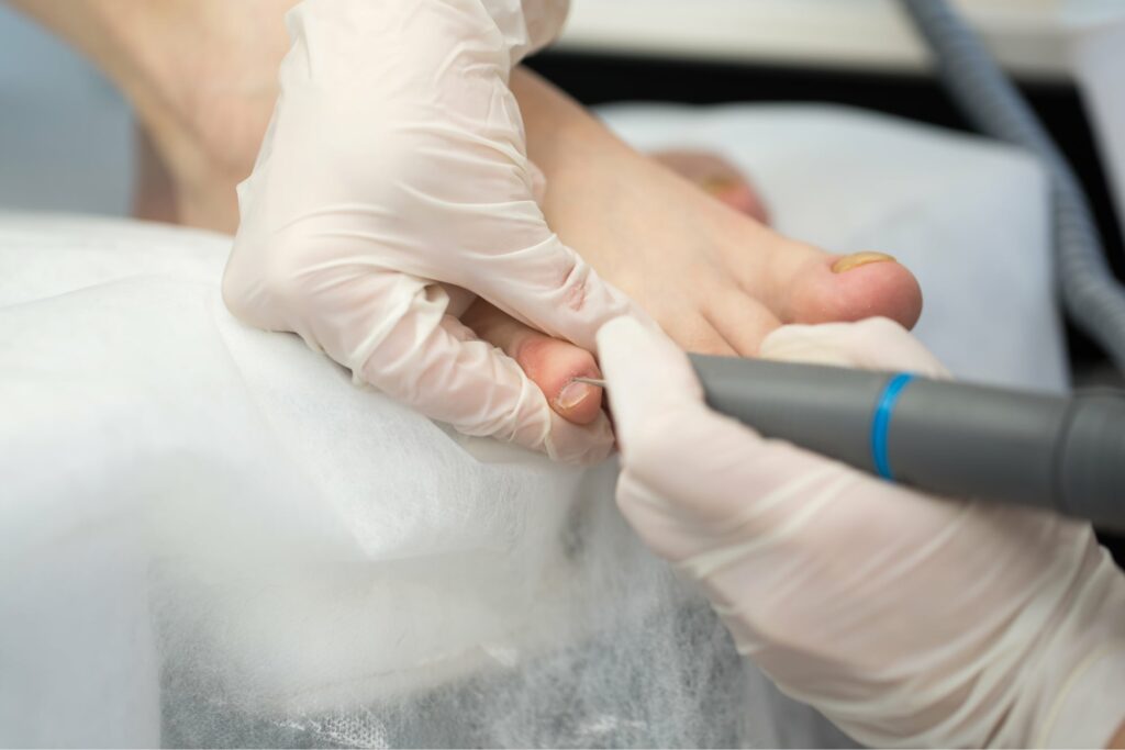 podiatry procedure with pedicure machine care of 2022 12 29 02 48 41 utc@2x